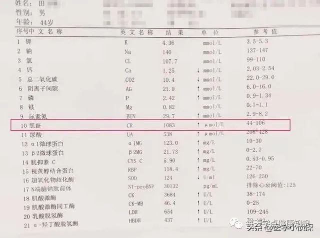 肌酐109，要立马透析吗？医生：且慢！别把肾透析没了
