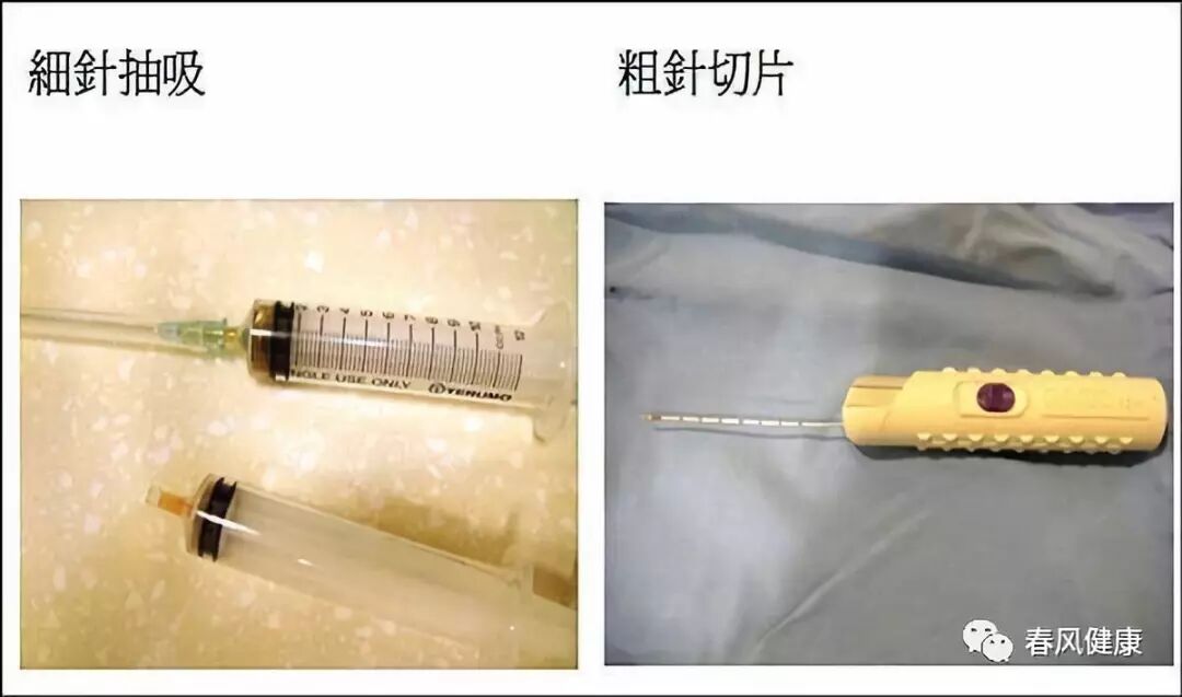 穿刺枪怎么升级乳腺穿刺术（三）_https://www.jmylbn.com_新闻资讯_第87张