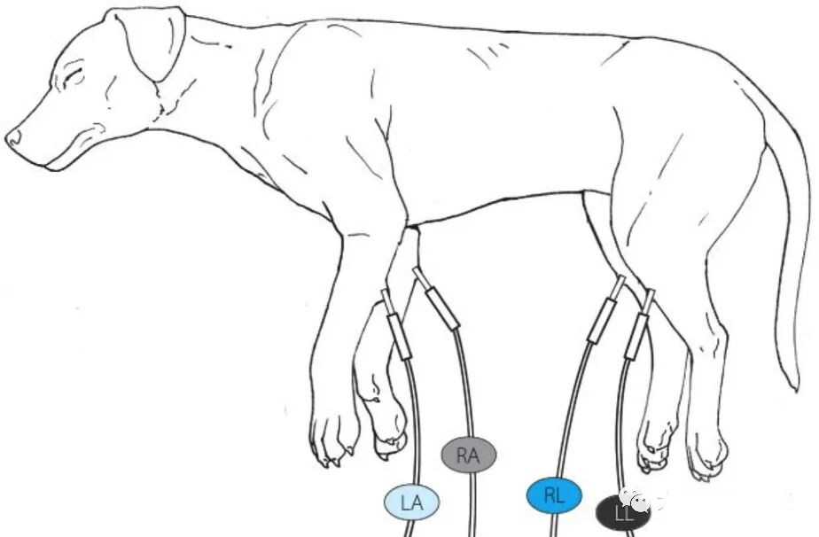 心电图滤波怎么选择【知跃干货】心电图基本示例_https://www.jmylbn.com_新闻资讯_第5张