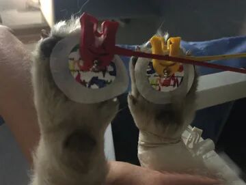 心电图滤波怎么选择【知跃干货】心电图基本示例_https://www.jmylbn.com_新闻资讯_第7张