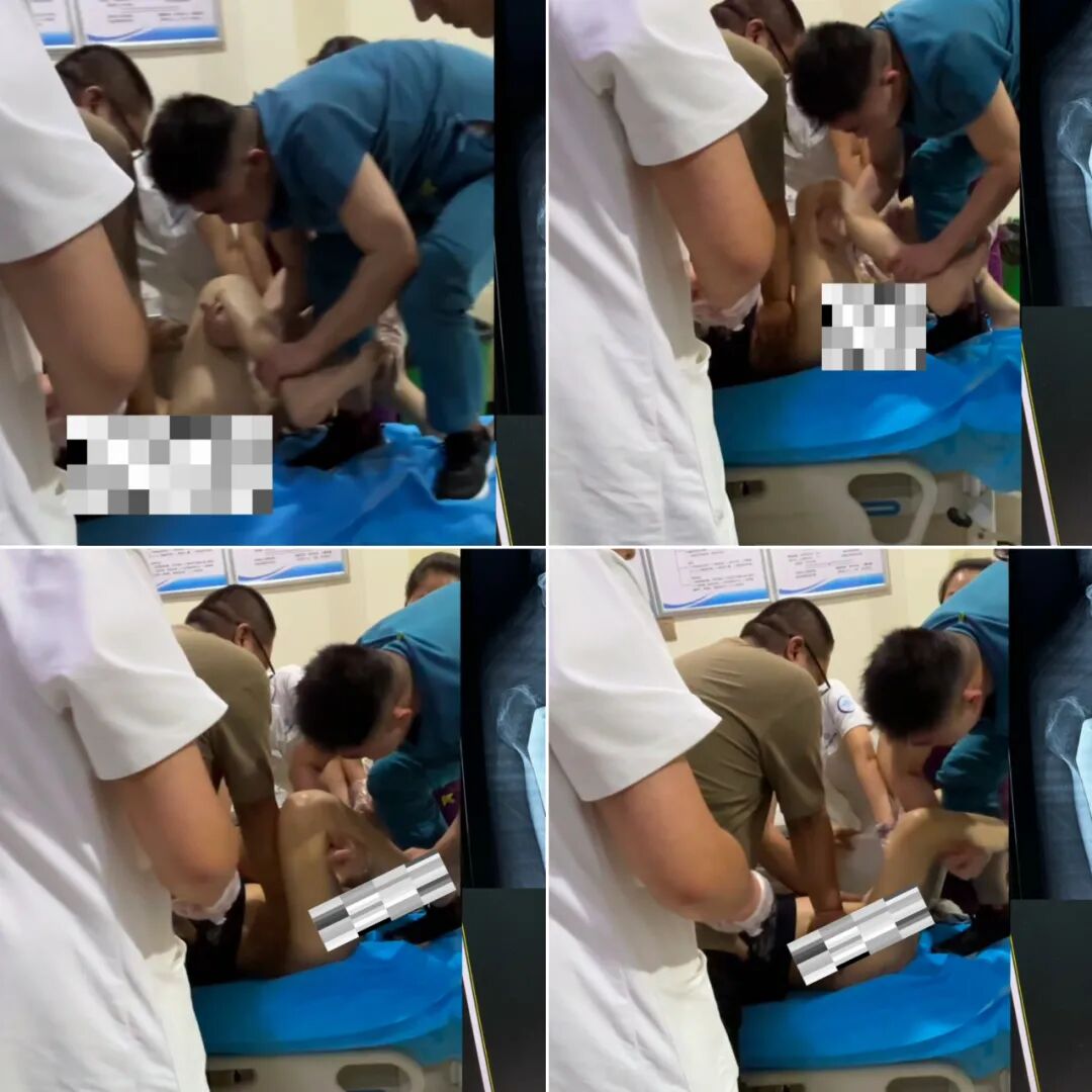 急诊来了髋关节脱位如何复位？骨科值班必备五种髋关节脱位闭合复位法！