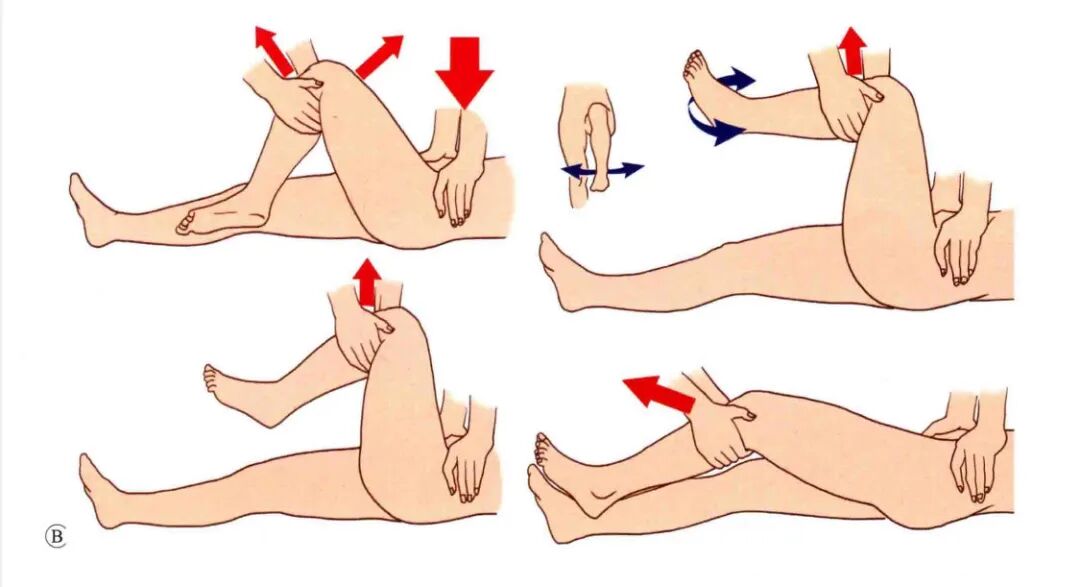 急诊来了髋关节脱位如何复位？骨科值班必备五种髋关节脱位闭合复位法！