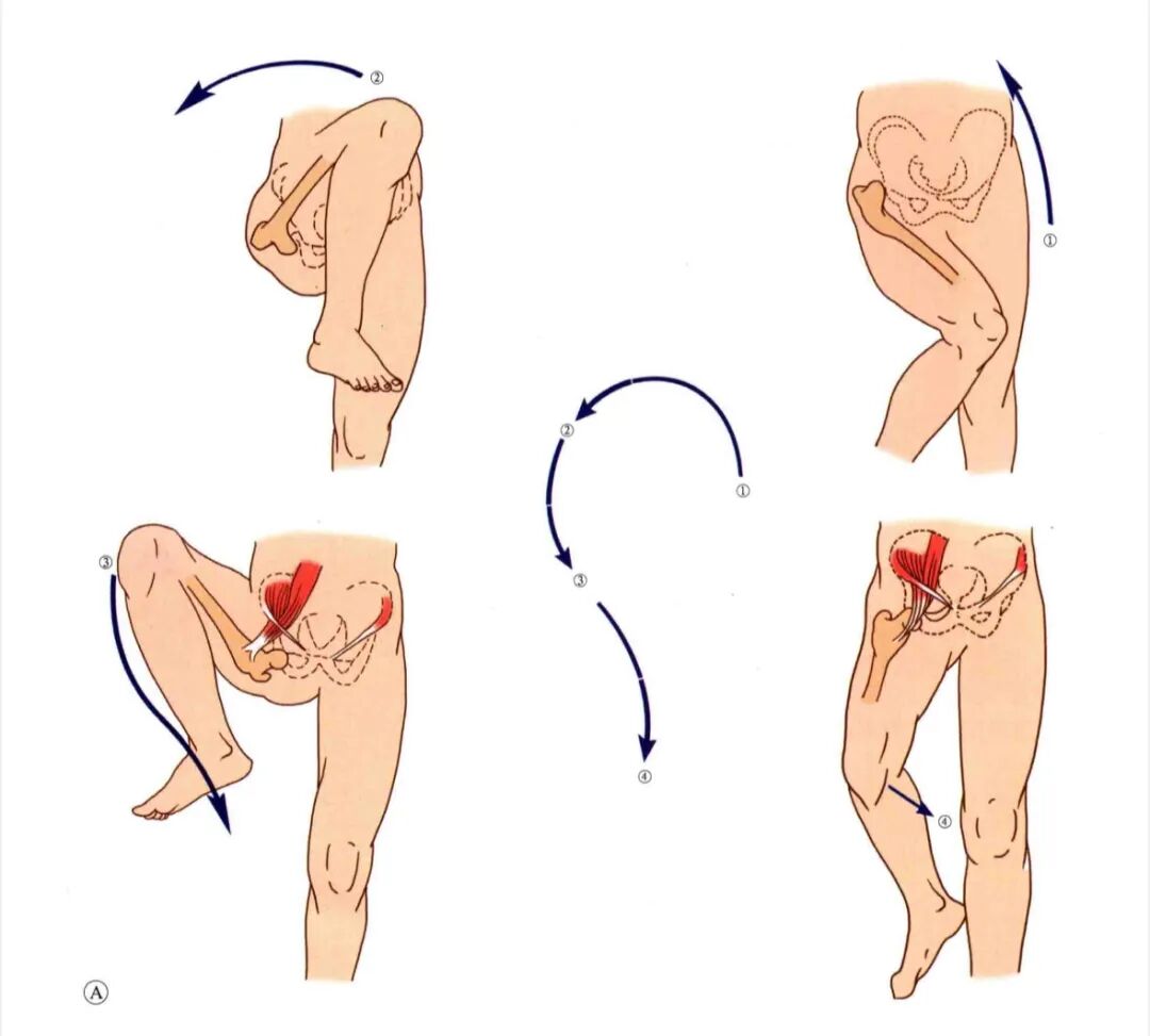 急诊来了髋关节脱位如何复位？骨科值班必备五种髋关节脱位闭合复位法！