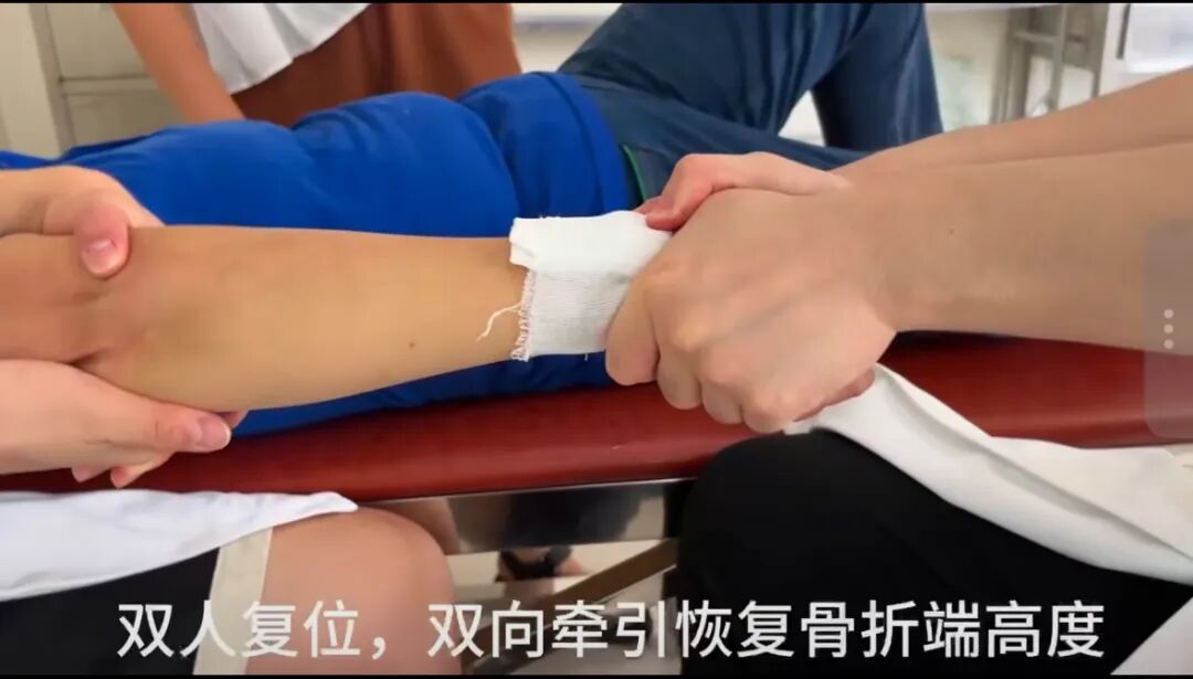 桡骨远端骨折详细手法复位法与复查、康复时间参考表！