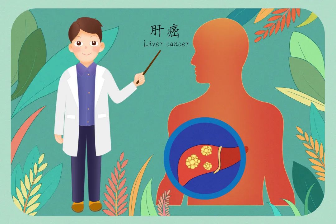 未来20年,患肝癌的人将激增55%?学会3招远离它! 未来20年,患肝癌的人将激增55%?学会3招远离它!