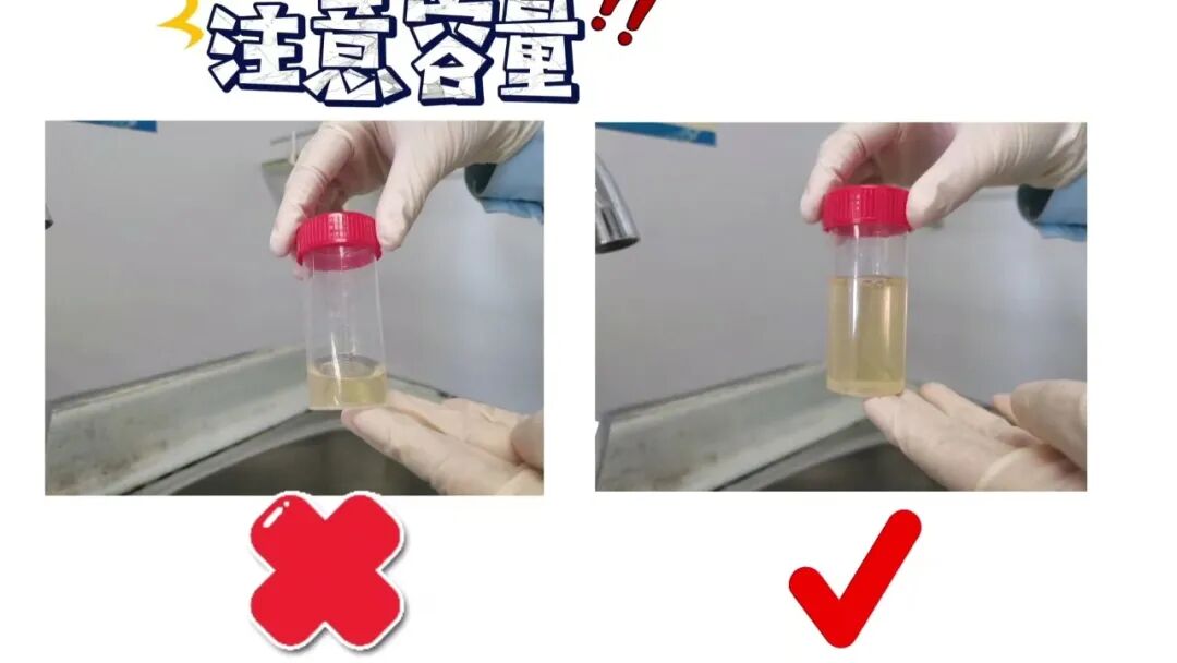化验大便怎么采集【入院须知三】大小便标本留取全攻略：让你事半功倍的操作技巧！_https://www.jmylbn.com_新闻资讯_第12张