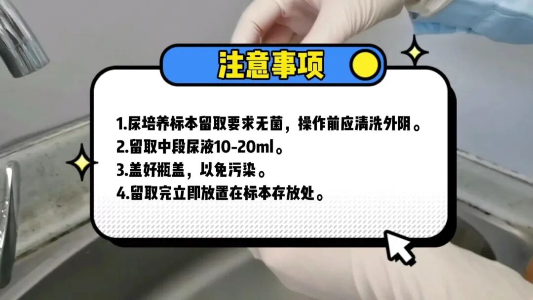 化验大便怎么采集【入院须知三】大小便标本留取全攻略：让你事半功倍的操作技巧！_https://www.jmylbn.com_新闻资讯_第10张