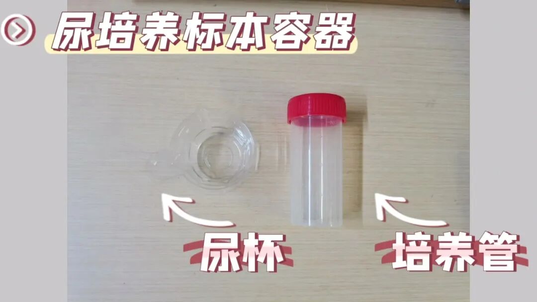 化验大便怎么采集【入院须知三】大小便标本留取全攻略：让你事半功倍的操作技巧！_https://www.jmylbn.com_新闻资讯_第9张