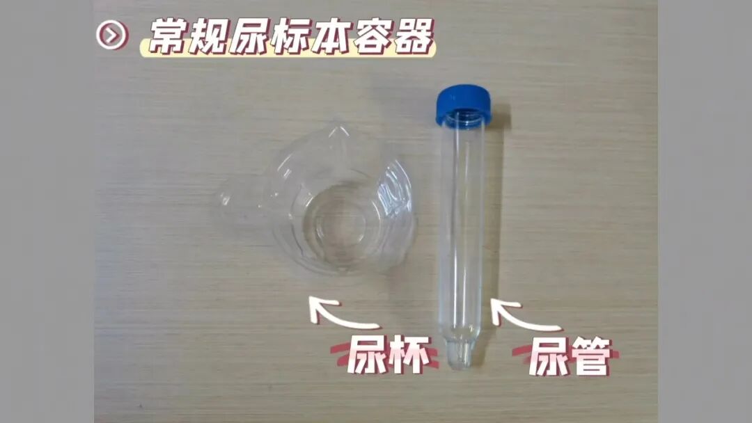 化验大便怎么采集【入院须知三】大小便标本留取全攻略：让你事半功倍的操作技巧！_https://www.jmylbn.com_新闻资讯_第6张