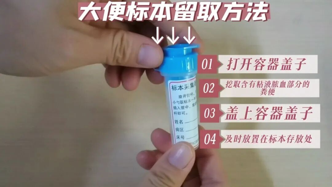 化验大便怎么采集【入院须知三】大小便标本留取全攻略：让你事半功倍的操作技巧！_https://www.jmylbn.com_新闻资讯_第15张