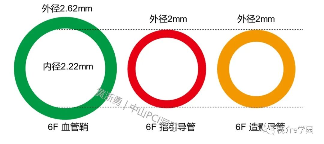 导管鞘怎么念中山PCI洞见｜64. 如何选择指引导管的内径？_https://www.jmylbn.com_新闻资讯_第3张