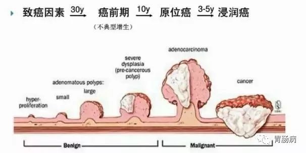 小心！這樣的大便，可能是大腸癌來臨！ 健康 第5張