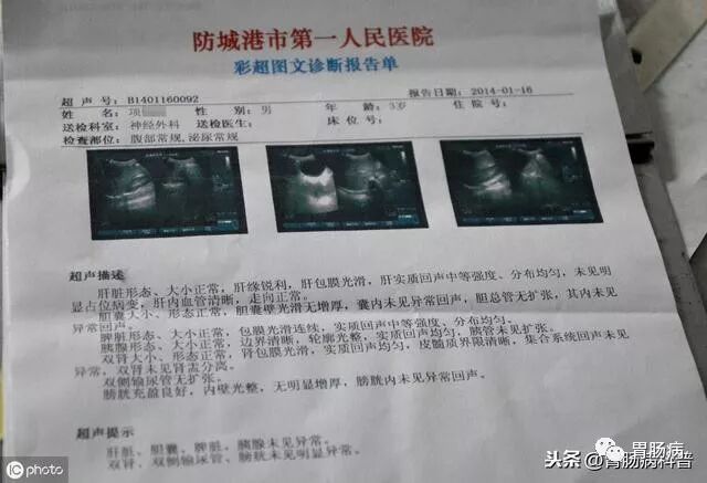 什么是260胃镜快速看懂：胃镜报告+活检病理报告_https://www.jmylbn.com_新闻资讯_第4张