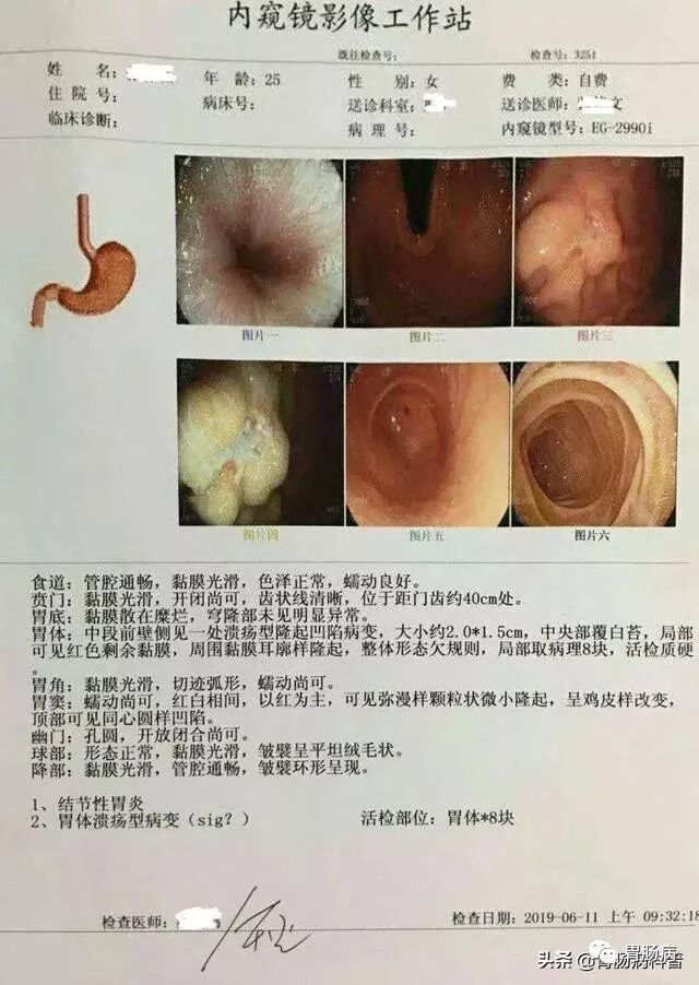 什么是260胃镜快速看懂：胃镜报告+活检病理报告_https://www.jmylbn.com_新闻资讯_第2张