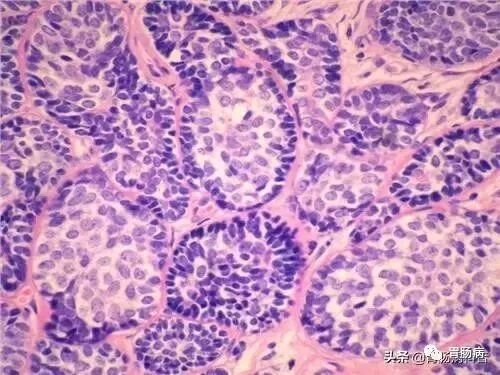 什么是260胃镜快速看懂：胃镜报告+活检病理报告_https://www.jmylbn.com_新闻资讯_第6张