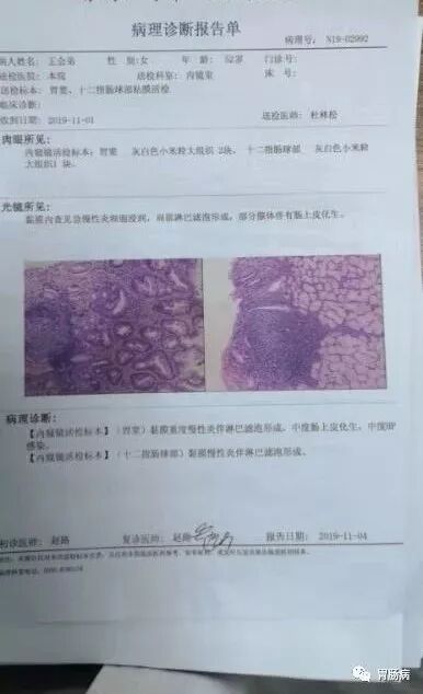 什么是260胃镜快速看懂：胃镜报告+活检病理报告_https://www.jmylbn.com_新闻资讯_第3张