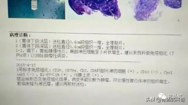 什么是260胃镜快速看懂：胃镜报告+活检病理报告_https://www.jmylbn.com_新闻资讯_第1张