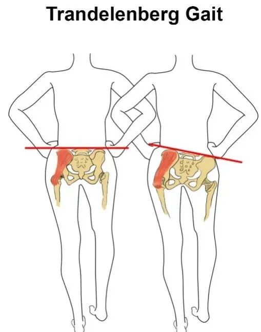步态分析上曲线怎么解读步态分析的常用方法，很实用！_https://www.jmylbn.com_新闻资讯_第8张