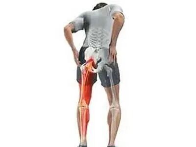 步态分析上曲线怎么解读步态分析的常用方法，很实用！_https://www.jmylbn.com_新闻资讯_第13张