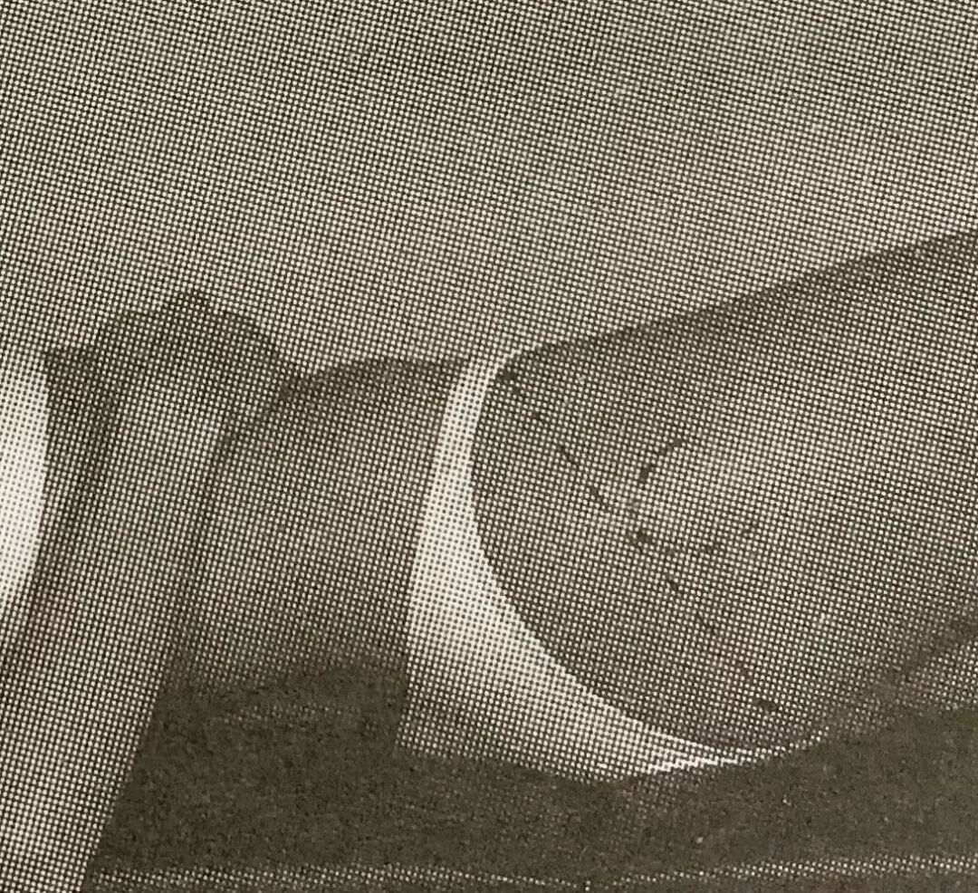 怎么评估病人肌力“肩 髋 膝 踝” 4大关节体格检查，干货速取！_https://www.jmylbn.com_新闻资讯_第35张