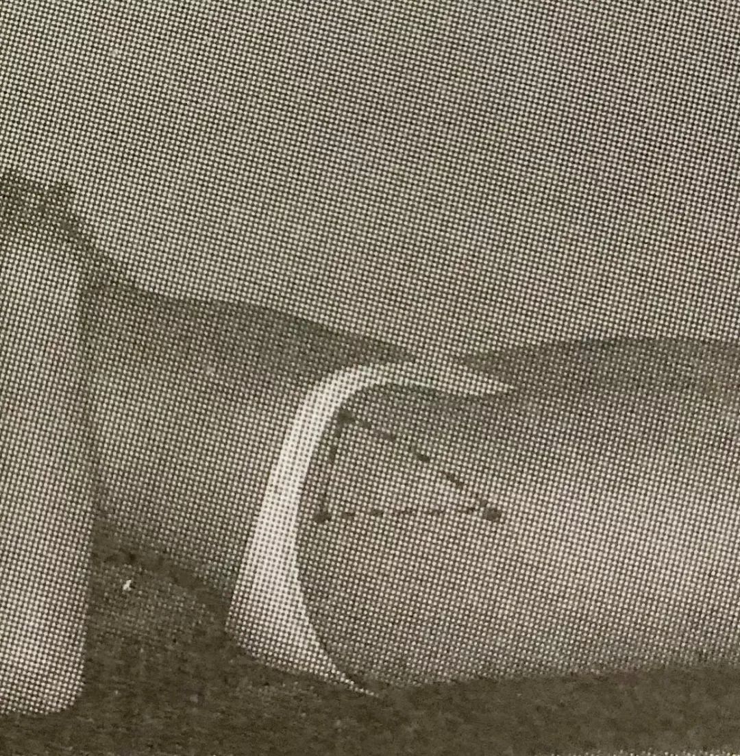 怎么评估病人肌力“肩 髋 膝 踝” 4大关节体格检查，干货速取！_https://www.jmylbn.com_新闻资讯_第34张