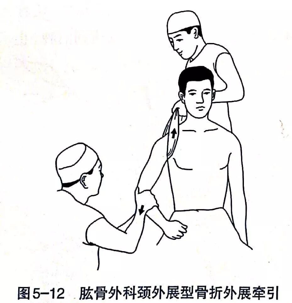 Illustration 1 for BC D型孟氏骨折及全身各部位骨折的专家级手法复位术：掌握技巧，告别痛苦，骨折康复更简单、更快速！