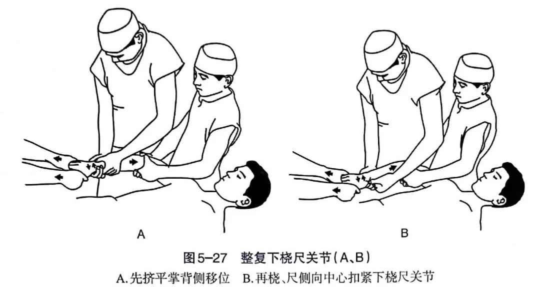 Illustration 22 for BC D型孟氏骨折及全身各部位骨折的专家级手法复位术：掌握技巧，告别痛苦，骨折康复更简单、更快速！