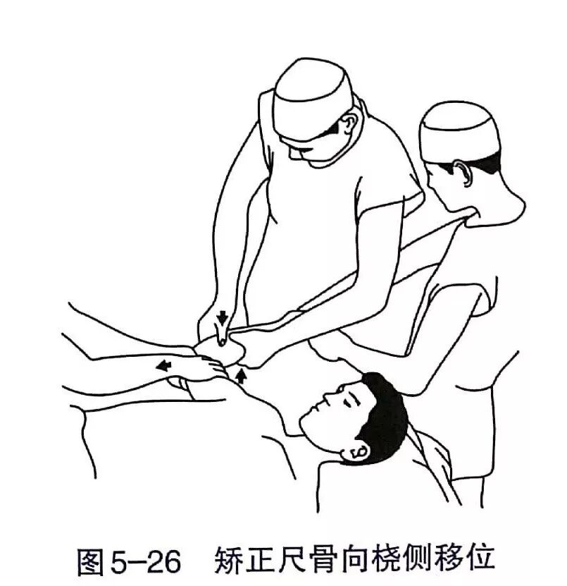 Illustration 20 for BC D型孟氏骨折及全身各部位骨折的专家级手法复位术：掌握技巧，告别痛苦，骨折康复更简单、更快速！