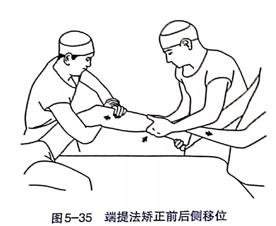 Illustration 32 for BC D型孟氏骨折及全身各部位骨折的专家级手法复位术：掌握技巧，告别痛苦，骨折康复更简单、更快速！