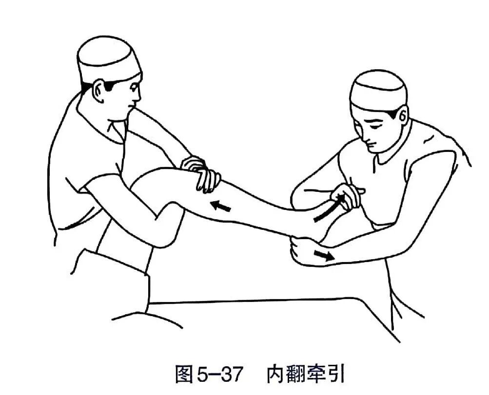 Illustration 35 for BC D型孟氏骨折及全身各部位骨折的专家级手法复位术：掌握技巧，告别痛苦，骨折康复更简单、更快速！