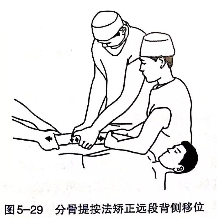 Illustration 24 for BC D型孟氏骨折及全身各部位骨折的专家级手法复位术：掌握技巧，告别痛苦，骨折康复更简单、更快速！