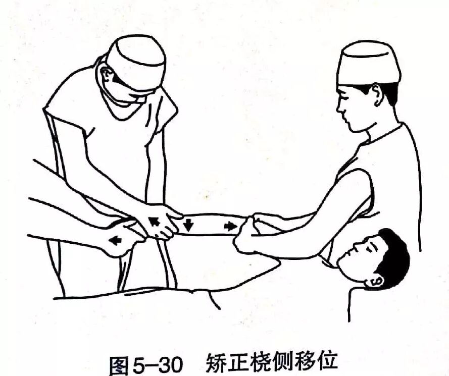 Illustration 26 for BC D型孟氏骨折及全身各部位骨折的专家级手法复位术：掌握技巧，告别痛苦，骨折康复更简单、更快速！