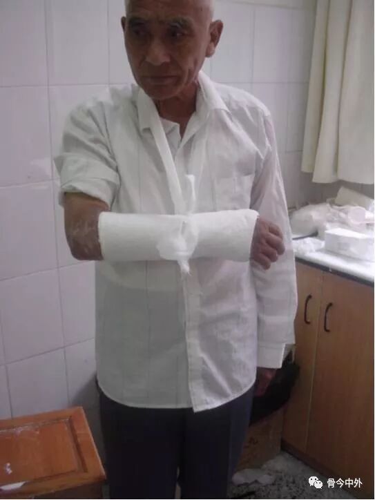 骨折石膏固定大百科-陆超杰住院医师-爱问医生