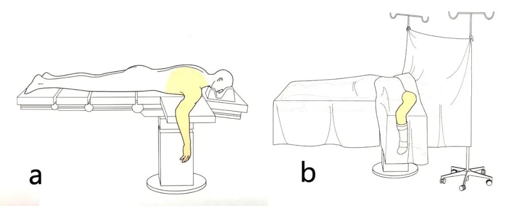 手术工具怎么消毒手术消毒及铺巾指北，欢迎收藏！_https://www.jmylbn.com_新闻资讯_第4张