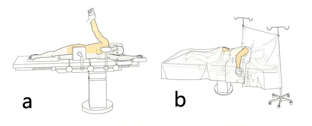 手术工具怎么消毒手术消毒及铺巾指北，欢迎收藏！_https://www.jmylbn.com_新闻资讯_第5张