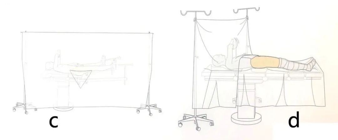 手术工具怎么消毒手术消毒及铺巾指北，欢迎收藏！_https://www.jmylbn.com_新闻资讯_第11张