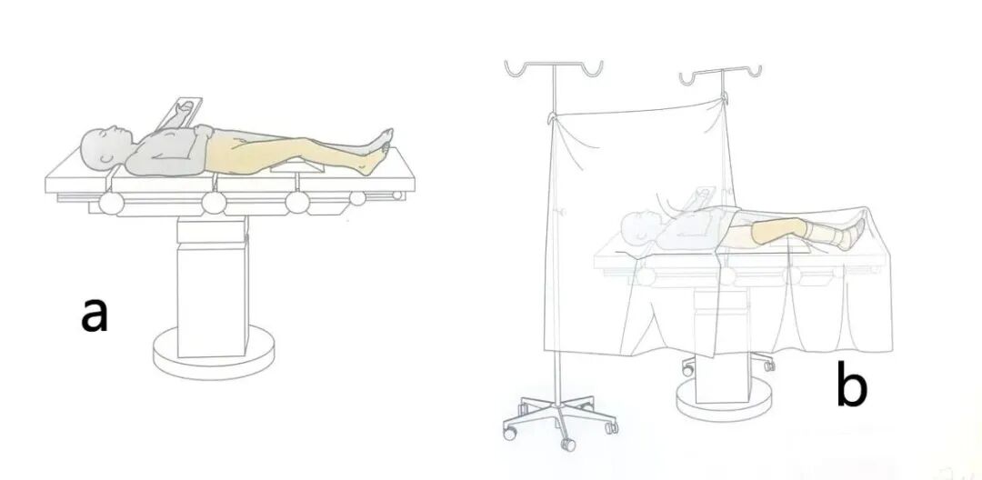 手术工具怎么消毒手术消毒及铺巾指北，欢迎收藏！_https://www.jmylbn.com_新闻资讯_第13张