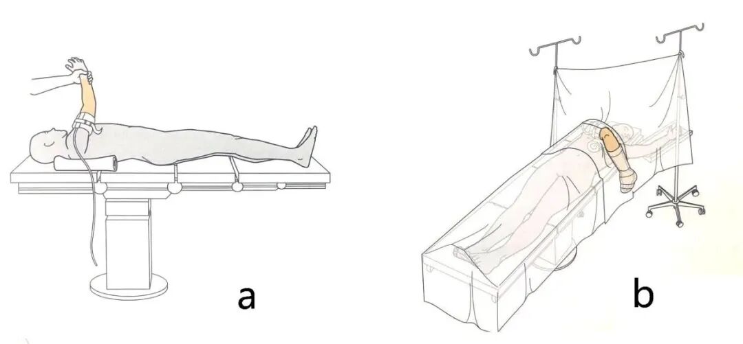 手术工具怎么消毒手术消毒及铺巾指北，欢迎收藏！_https://www.jmylbn.com_新闻资讯_第6张