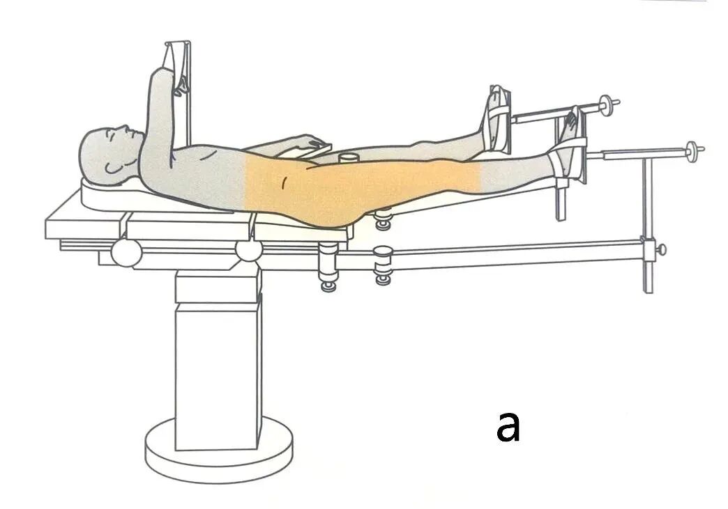 手术工具怎么消毒手术消毒及铺巾指北，欢迎收藏！_https://www.jmylbn.com_新闻资讯_第10张