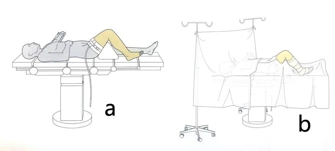 手术工具怎么消毒手术消毒及铺巾指北，欢迎收藏！_https://www.jmylbn.com_新闻资讯_第15张