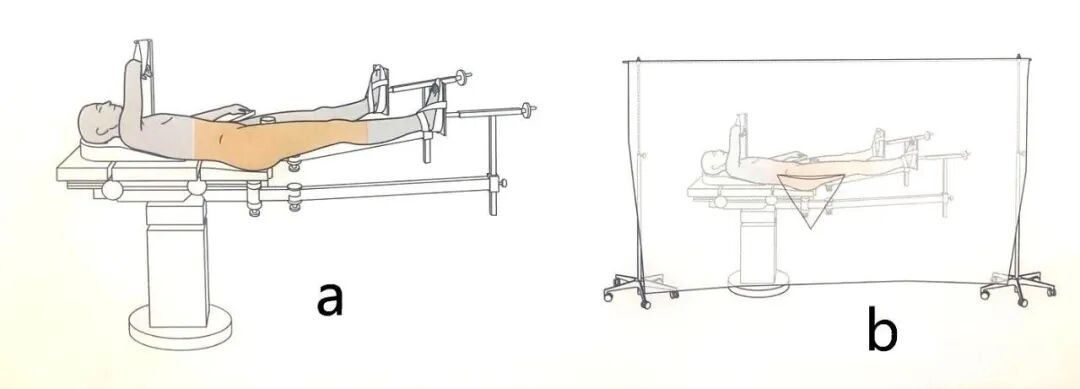 手术工具怎么消毒手术消毒及铺巾指北，欢迎收藏！_https://www.jmylbn.com_新闻资讯_第9张