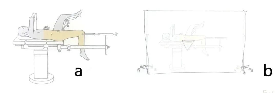 手术工具怎么消毒手术消毒及铺巾指北，欢迎收藏！_https://www.jmylbn.com_新闻资讯_第12张