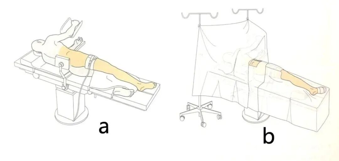 手术工具怎么消毒手术消毒及铺巾指北，欢迎收藏！_https://www.jmylbn.com_新闻资讯_第18张