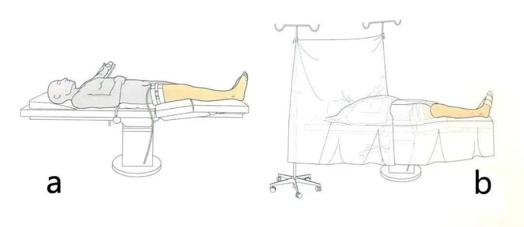 手术工具怎么消毒手术消毒及铺巾指北，欢迎收藏！_https://www.jmylbn.com_新闻资讯_第17张