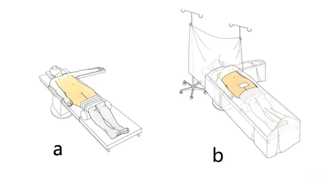 手术工具怎么消毒手术消毒及铺巾指北，欢迎收藏！_https://www.jmylbn.com_新闻资讯_第8张