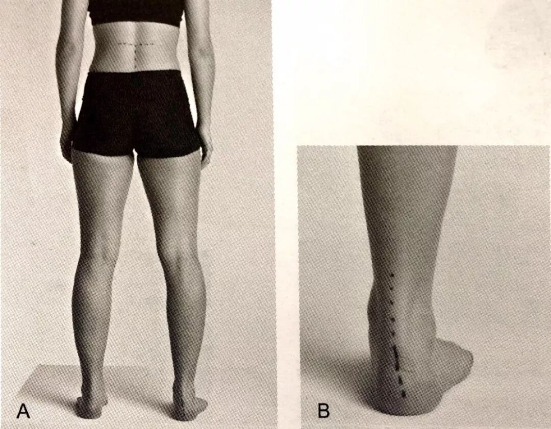 怎么评估病人肌力“肩 髋 膝 踝” 4大关节体格检查，干货速取！_https://www.jmylbn.com_新闻资讯_第50张
