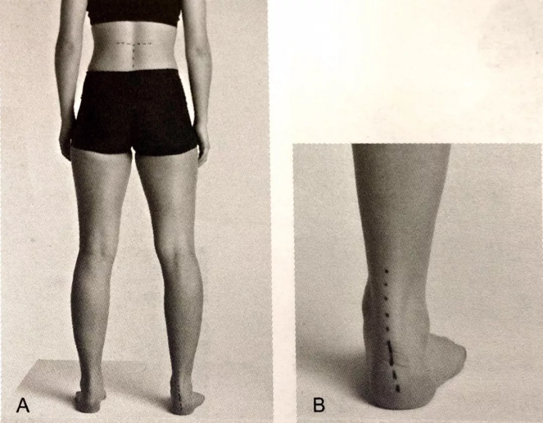 怎么评估病人肌力“肩 髋 膝 踝” 4大关节体格检查,干货速取!_新闻资讯_第50张_活检穿刺产品网 怎么评估病人肌力“肩 髋 膝 踝” 4大关节体格检查,干货速取!_https://www.jmylbn.com_新闻资讯_第50张
