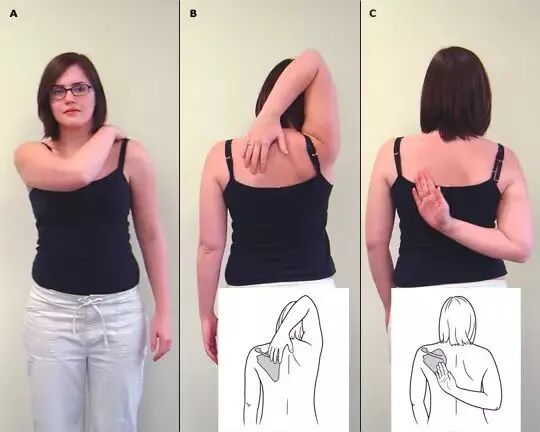 怎么评估病人肌力“肩 髋 膝 踝” 4大关节体格检查，干货速取！_https://www.jmylbn.com_新闻资讯_第12张