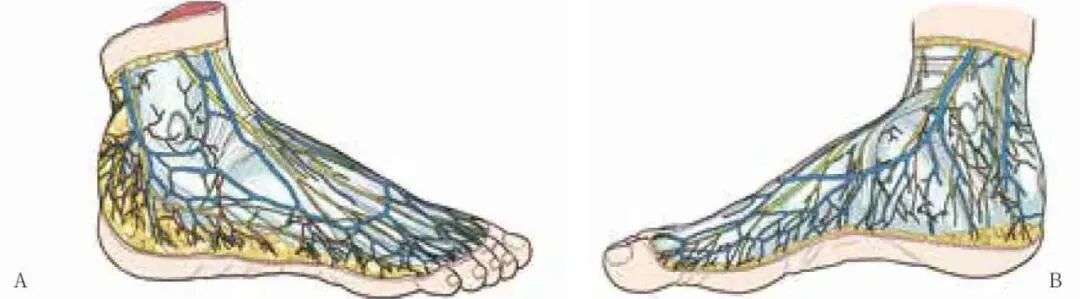 缝合器都有哪些厂家跟腱断裂常用的四种缝合修复方法，你都知道吗？_https://www.jmylbn.com_新闻资讯_第2张