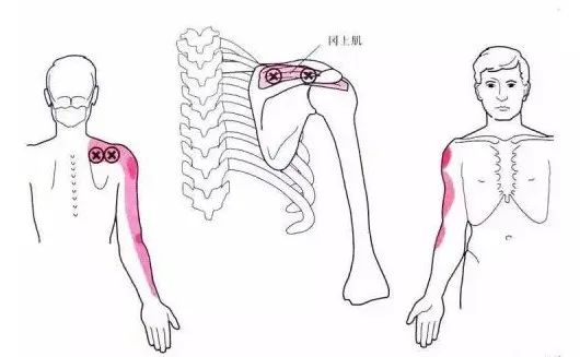 怎么评估病人肌力“肩 髋 膝 踝” 4大关节体格检查，干货速取！_https://www.jmylbn.com_新闻资讯_第5张